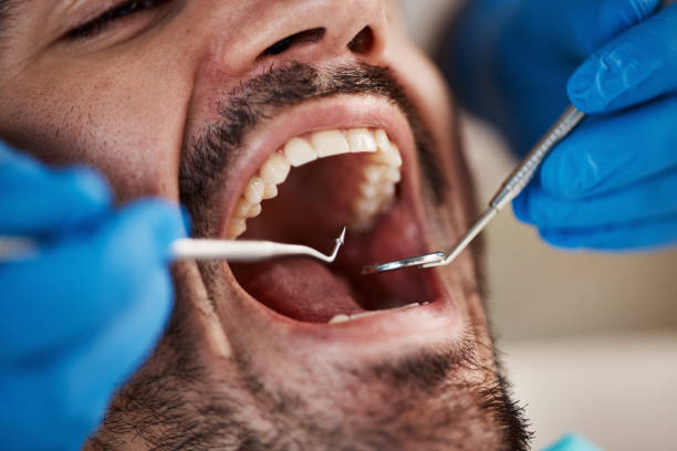 Best Broken Tooth Emergency  in Norwich, CT