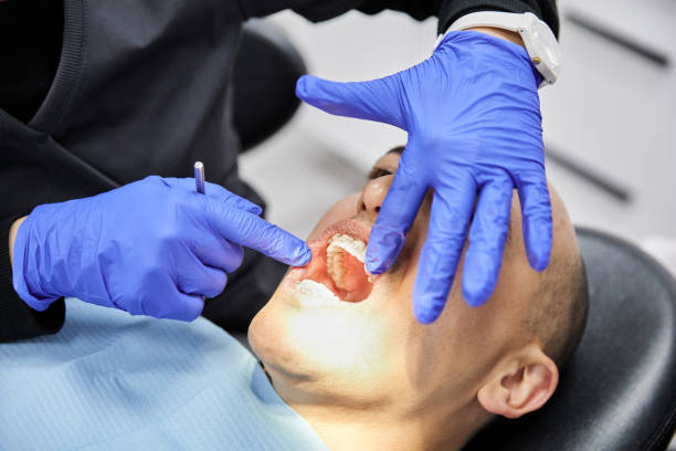 Best Dentist for Dental Trauma  in Norwich, CT