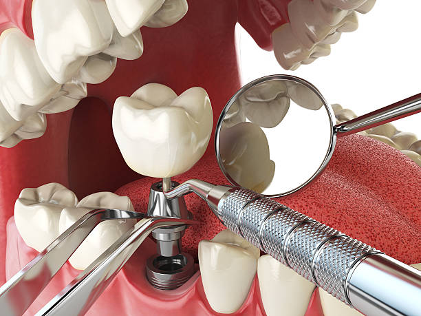 Tooth Infection Emergency Dentist in CT